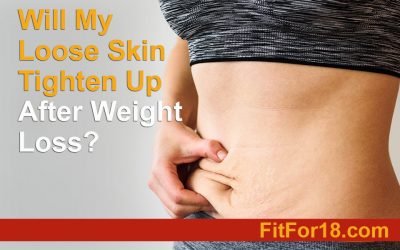 Will My Loose Skin Tighten Up After Weight Loss?