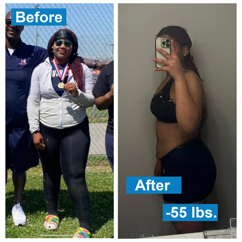 Women's before and after weight loss pic